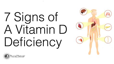 vitamin d foods reddit|vitamin d deficiency symptoms reddit.